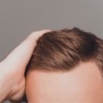 Hair Restoration Surgery: The Benefits and Consequences