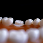 Early Treatment and Adult Orthodontics in Australia